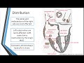 Carcinoid Heart Disease: The known and yet to be known.