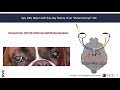 neuroimaging takeover week 4 case outcome