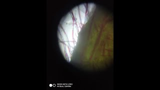 Foldscope Demo