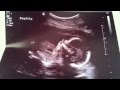 Words To My Unborn