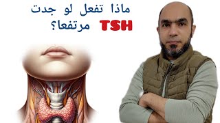 خمول الغدة الدرقية؟ متي أبدأ علاج لهرمون TSH المرتفع؟ومتي أتابعه فقط بدون علاج@Dr_youssef#اكسبلور