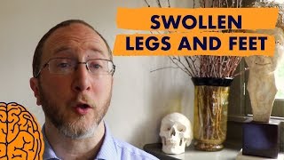 Multiple Sclerosis Symptoms Video: Swollen Legs and Feet
