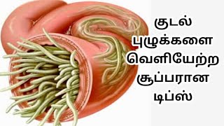 ஒரே நாளில் வயிற்றுப் பூச்சி (குடற்புழு)வெளியேற எளிய மருந்து |Stomach worms home remedy