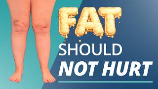 How to Know If You Have Lipedema (Not Just Cellulite) – Early Signs & Symptoms