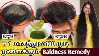 முடி கொட்டி போய் கலக்கமா தெரியுதா? Just 30 days போதும் - Best Badness Hair Regrowth Solution at Home