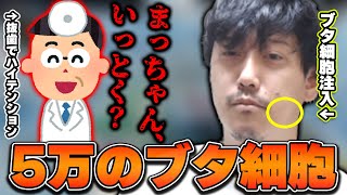 抜歯の跡に5万円のブタの細胞を埋め込まれていた布団ちゃん【2022/4/12】