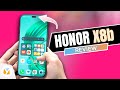 HONOR X8b Review,  It looks like an...🍎