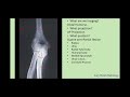 positioning of the elbow episode 11 lazybonesradiology