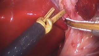 Laparoscopic cholecystectomy in dog (2/6).