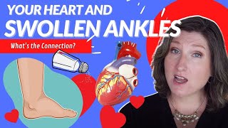 Swollen ankles &  your heart - Can leg swelling cause heart disease? GERI-Minute #176