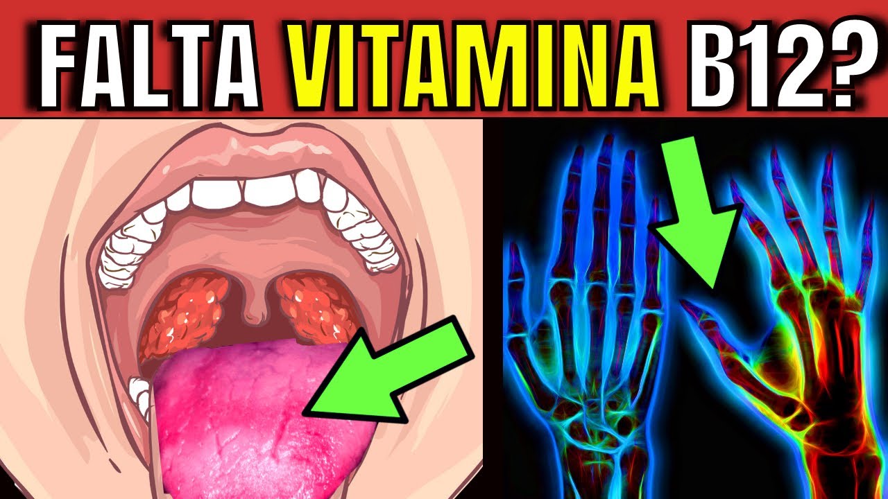 4 SINTOMAS De FALTA VITAMINA B12 NO SEU CORPO Que Você NÃO Pode Ignorar ...