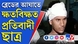 বাজি ফাটানোর প্রতিবাদ, তাতেই ব্লেডের আঘাত উচ্চ-মাধ্যমিক পরীক্ষার্থীর গায়ে | Baruipur News Update