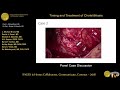 Timing & treatment of cholelithiasis: Panel case discussion