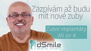 Moje cesta ke krásnému úsměvu Zubní implantáty Jak probíhá implantace zubů?