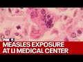 Measles exposure at Cohen Children's Medical Center on Long Island