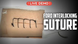 Ford Interlocking Suture || How to do Suture ?