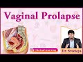 30. Vaginal Prolapse : OBG Lectures