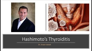 Hashimoto's Thyroiditis: What is it?