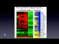 Pinpointing Genes Leading to Cataracts and Glaucoma