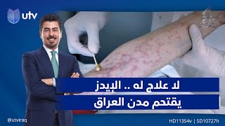 لا علاج له .. الإيـ.ـدز يقتحم مدن العراق | تقرير: مع ملا طلال