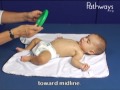 6 Month Old Babies Supine (laying on back) Position Typical and Atypical Development Comparison