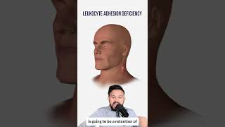 Leukocyte Adhesion Deficiency for the USMLE | HyGuru