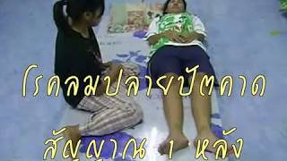 โรคลมปลายปัตคาดสัญญาณ 1 หลัง