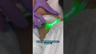 BRYGHT Underarm Treatment