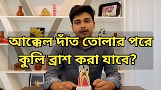 আক্কেল দাঁত তোলার পরে কুলি-ব্রাশ করা যাবে? || After wisdom Tooth Extraction can be brush?