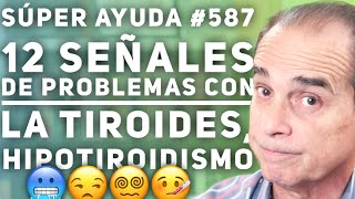 SÚPER AYUDA #587 12 Señales De Problemas Con La Tiroides, Hipotiroidismo