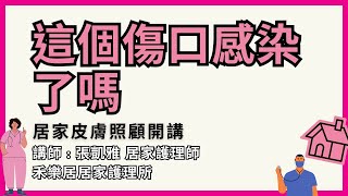 【居家皮膚照顧開講】第11集＿這個傷口感染了嗎＿張凱雅＿禾樂居居家護理所