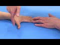 hand examination thumb extension and abduction epl epb and abpl