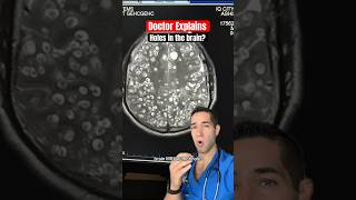 Doctor Reacts: parasites in the brain?!