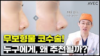 무보형물 코수술 ㅣ 누구에게 \u0026 왜 추천될까?