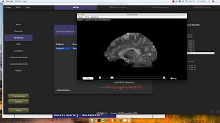UMass Amherst CONN Workshop, Part 3: Preprocessing