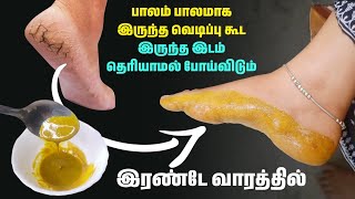 2 வாரத்தில் பித்த வெடிப்புக்கு ஒரே தீர்வு how to cure cracked heels in tamil