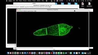 How to process a z-stack image into a 2D image in ImageJ | How to process confocal microscope images