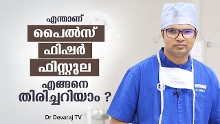 പൈൽസ്, ഫിസ്റ്റുല, ഫിഷർ,എങ്ങനെ തിരിച്ചറിയാം ? Dr Devaraj TV | Piles, fistula and fisher symptoms