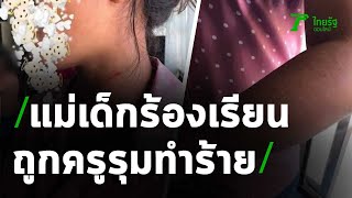 แม่นักเรียนอนุบาลร้องเรียนถูกครูรุมทำร้าย | 13-10-63 | ข่าวเช้าหัวเขียว