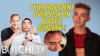 Tyler's Bicep Implants FLIP In His Arm?! | Botched | E!