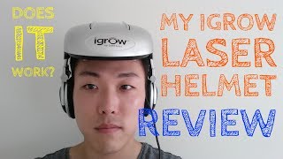 I Got An iGrow Laser Helmet!