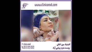 تزریق چریی به گونه و جوان  سازی صورت دربهترین کلینیک بین المللی