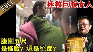 王剛講故事 第94期：拯救巨腹女人：女子身患怪病，腹圍竟有五尺！往事不堪回首，是怪胎？還是絕症？巨大肚子裏，究竟隱藏著怎樣驚人的秘密？