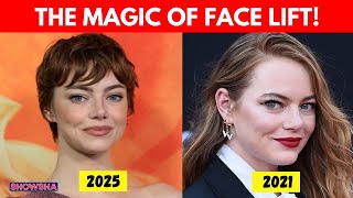 Emma Stone’s 'New Face' Sparks Buzz After Kris Jenner & Anne Hathaway’s Glow-Ups: EXPLAINED | N18G