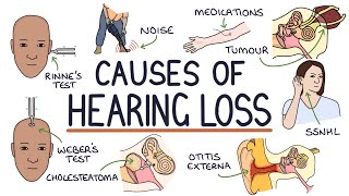 Understanding the Causes of Hearing Loss