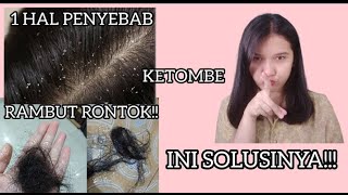 TERNYATA INI PENYEBAB NYA DAN CARA MENGATASINYA. RAMBUT RONTOK DAN KETOMBE LANGSUNG HEMPAS || TiisaZ