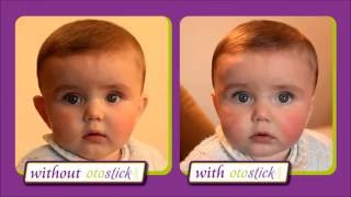 Otostick® Baby - Reduces prominent ears without surgery