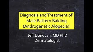 Diagnosis and Treatment of Male Pattern Balding (Male Androgenetic Alopecia)