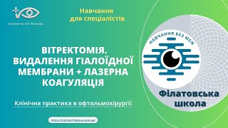 Вітректомія. Видалення гіалоїдної мембрани + лазерна коагуляція