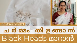 Black Heads(ബ്ലാക്ക് ഹെഡ്സ്) ഇല്ലാതാക്കാൻ /Black heads natural remedies/Black heads removal